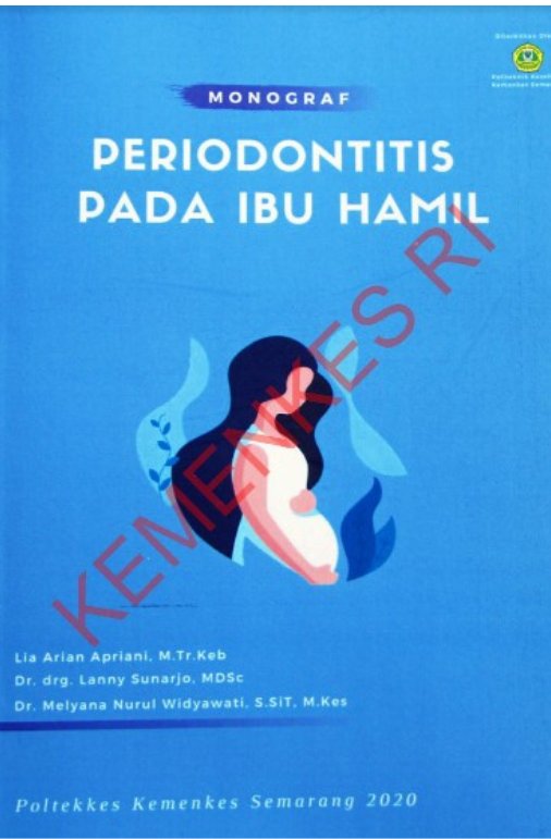 Sampul Monograf Periodontitis Pada Ibu Hamil