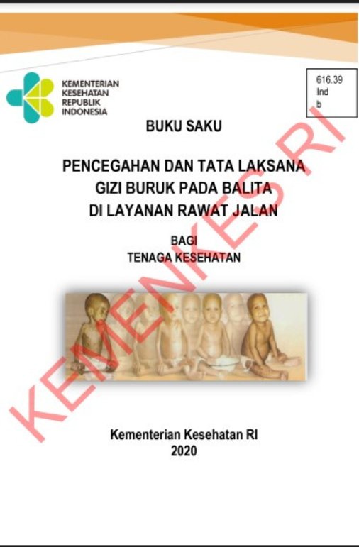Sampul Buku Saku Pencegahan dan Tata Laksana Gizi Buruk Pada Balita di Layanan Rawat Jalan Bagi Tenaga Kesehatan