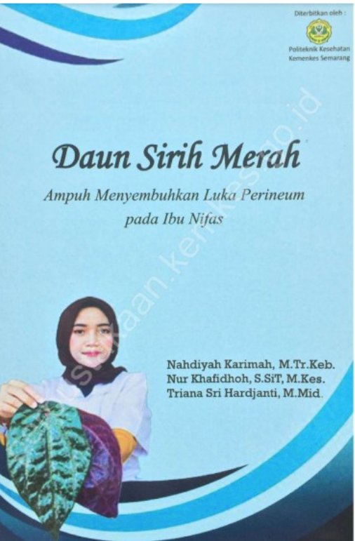 Sampul Daun Sirih Merah Ampuh Menyembuhkan Luka Perineum pada Ibu Nifas